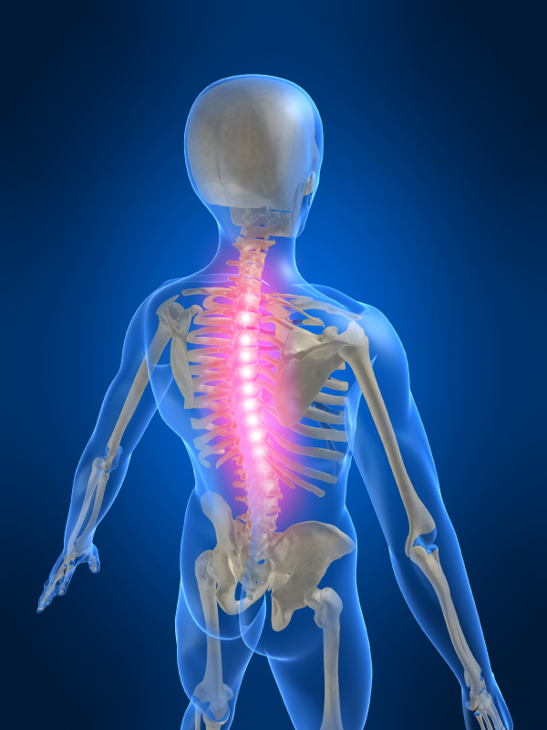 Illuminated model of spine outlining vertebrae and potential spine pain